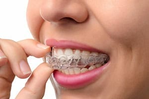 woman putting invisalign clear braces on her upper teeth with pink lipstick