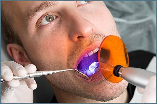 Image depicting a dental bonding procedure using laser technology. The scene shows a dentist using a dental laser to apply bonding material to a tooth surface. The focused laser beam is precisely shaping and hardening the bonding material on the tooth. The dental instrument and laser equipment are visible in the background, with a controlled and precise application process underway.